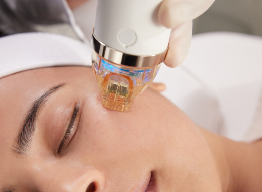Microneedling for Skin Rejuvenation