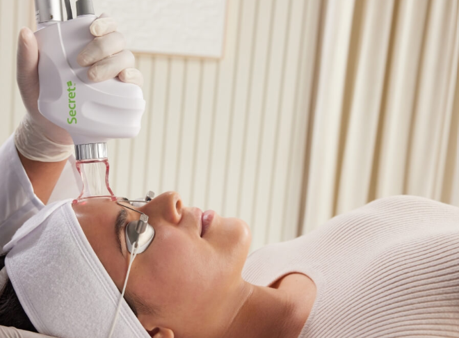 Secret Rf Microneedling treatment